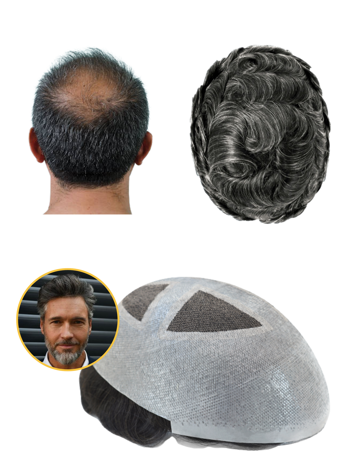 اليونت الشبكية شيب 20% شاملا مواد التركيب 8*10