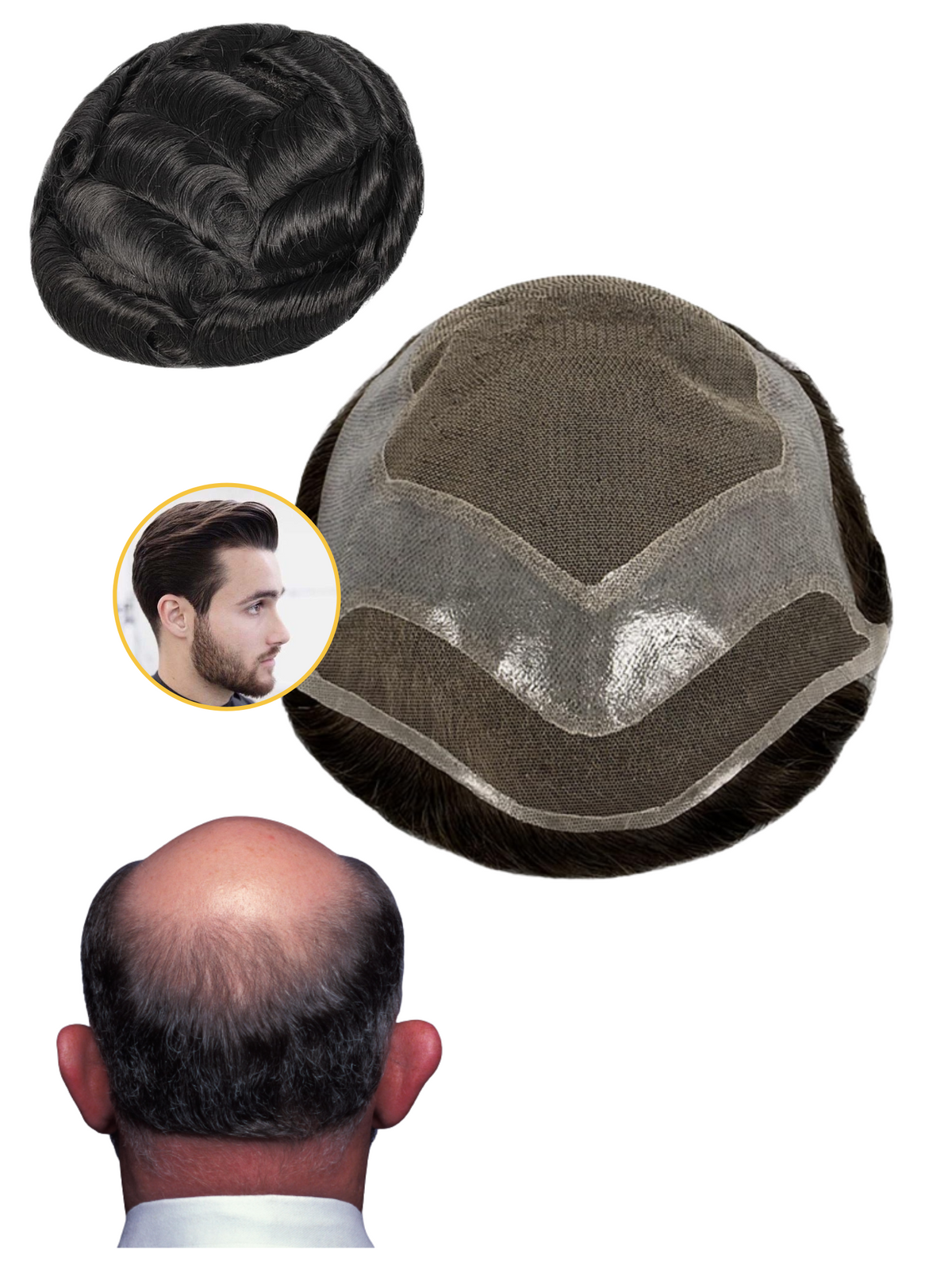 اليونت الشبكية شاملا مواد التركيب" 6*9