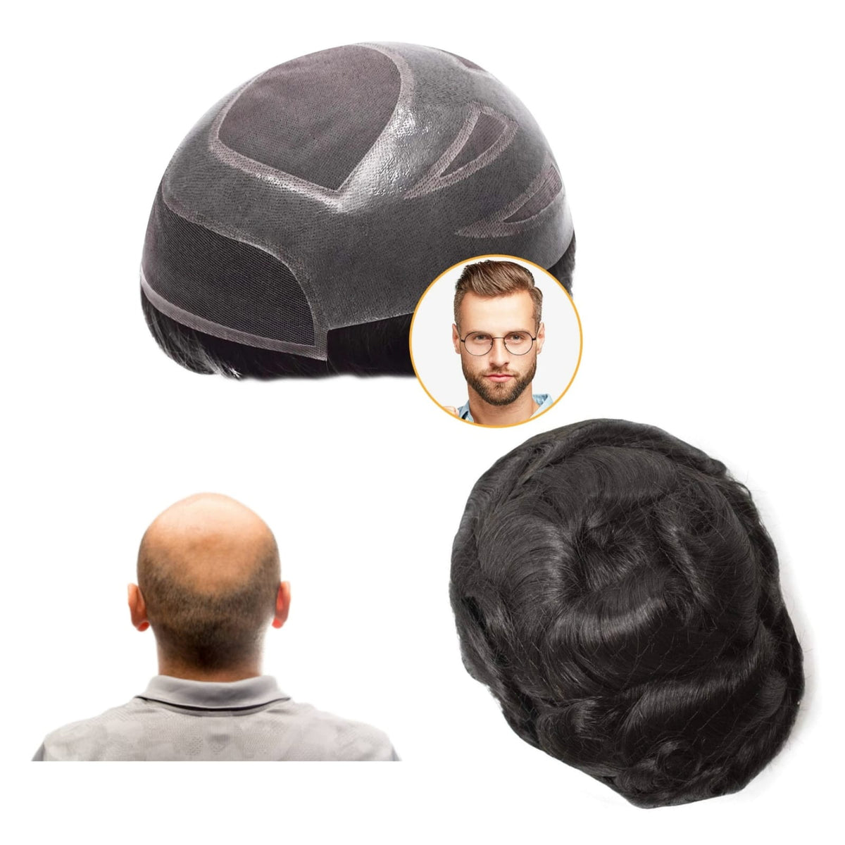 اليونت الشبكية شاملا التركيب ( تابي - تمارا - فرق القيمة )