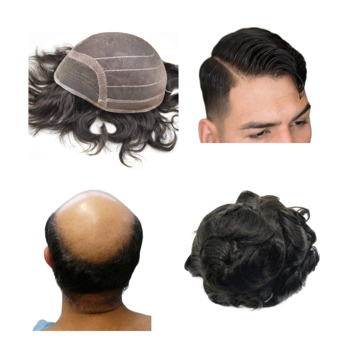 اليونت الشبكية شاملا مواد التركيب 20 سم" 7*9