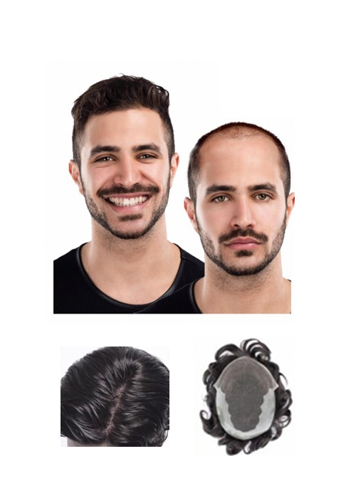 اليونت الشبكية شاملا مواد التركيب 9"*7